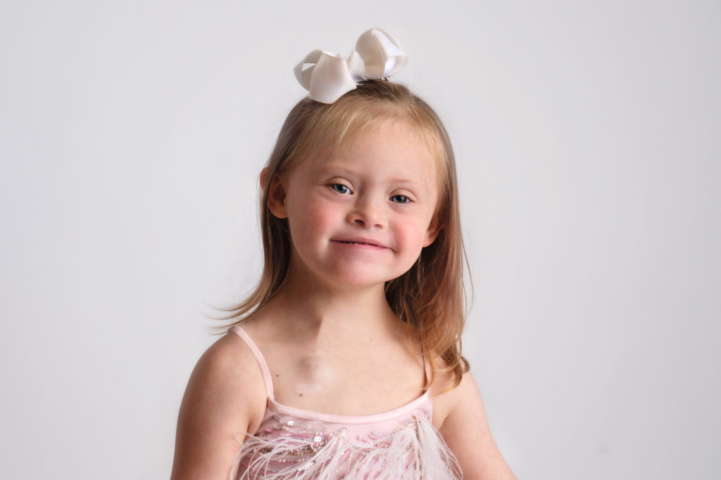 Child cancer survivor.  Chemo port. Downs Syndrome beauty.